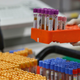A lab technician preparing blood samples for covid-19 antibody testing.
